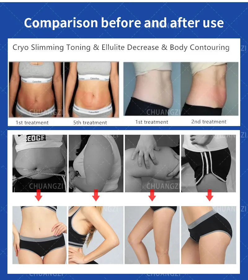 Professional Dual-Temperature Skin Contouring Device Portable Body Firming Equipment CE Certified Non-Invasive Cooling Tech
